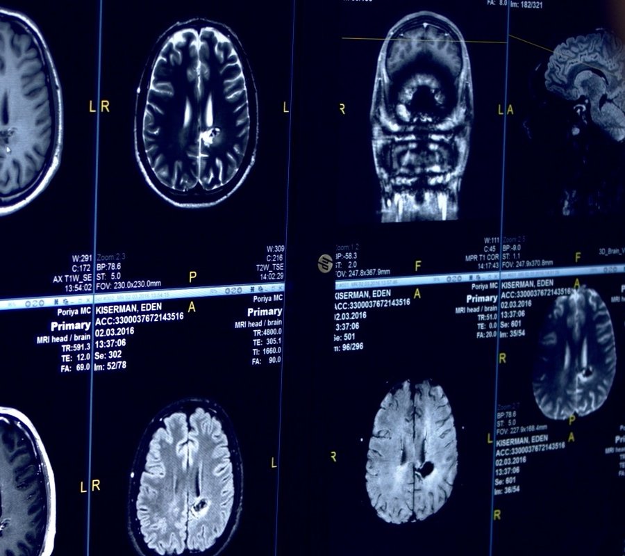 Behavioral Neuroscience: Intraoperative Neurophysiological Monitoring